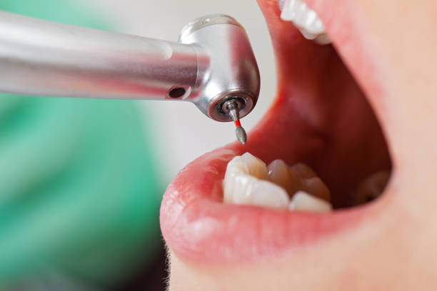 Best Walk-In Emergency Dentist in Daphne, AL